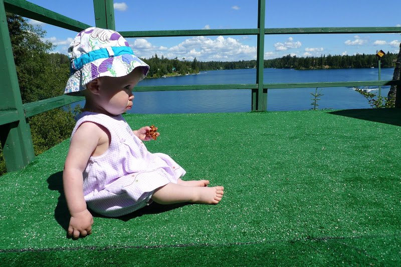 Sweetpea’s Surgery: Bilateral Trigger Thumb Release